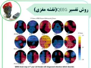 تفسیر نقشه مغزی